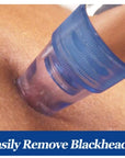 blackhead remover