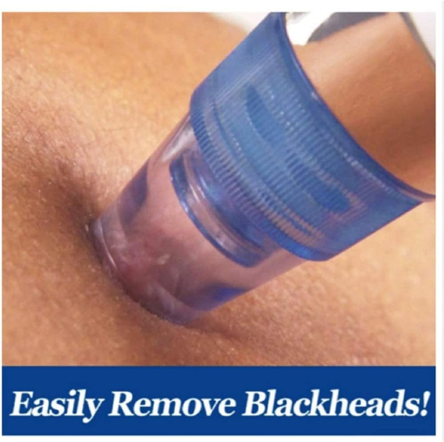 blackhead remover