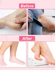 Silicone Foot Care Socks Anti Cracking Moisturizing Gel Socks Exfoliating Dead Skin Remove Pain Relief 2pcs/Pair