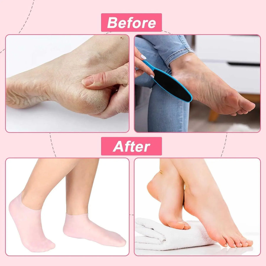 Silicone Foot Care Socks Anti Cracking Moisturizing Gel Socks Exfoliating Dead Skin Remove Pain Relief 2pcs/Pair