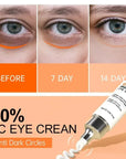 best eye cream for dark circles and wrinkles